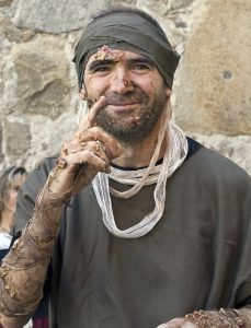 Los otros leprosos, no el agradecido